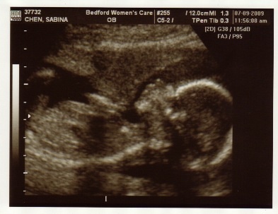 Baby Bean at 19 weeks